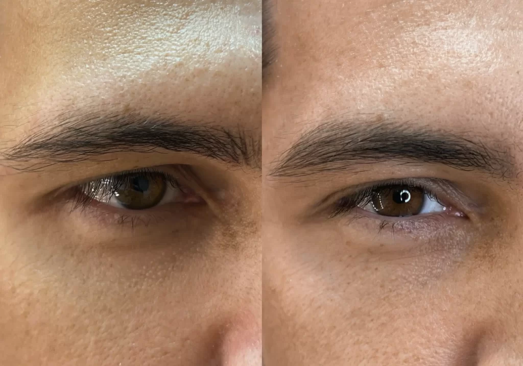 microblading in Melbourne