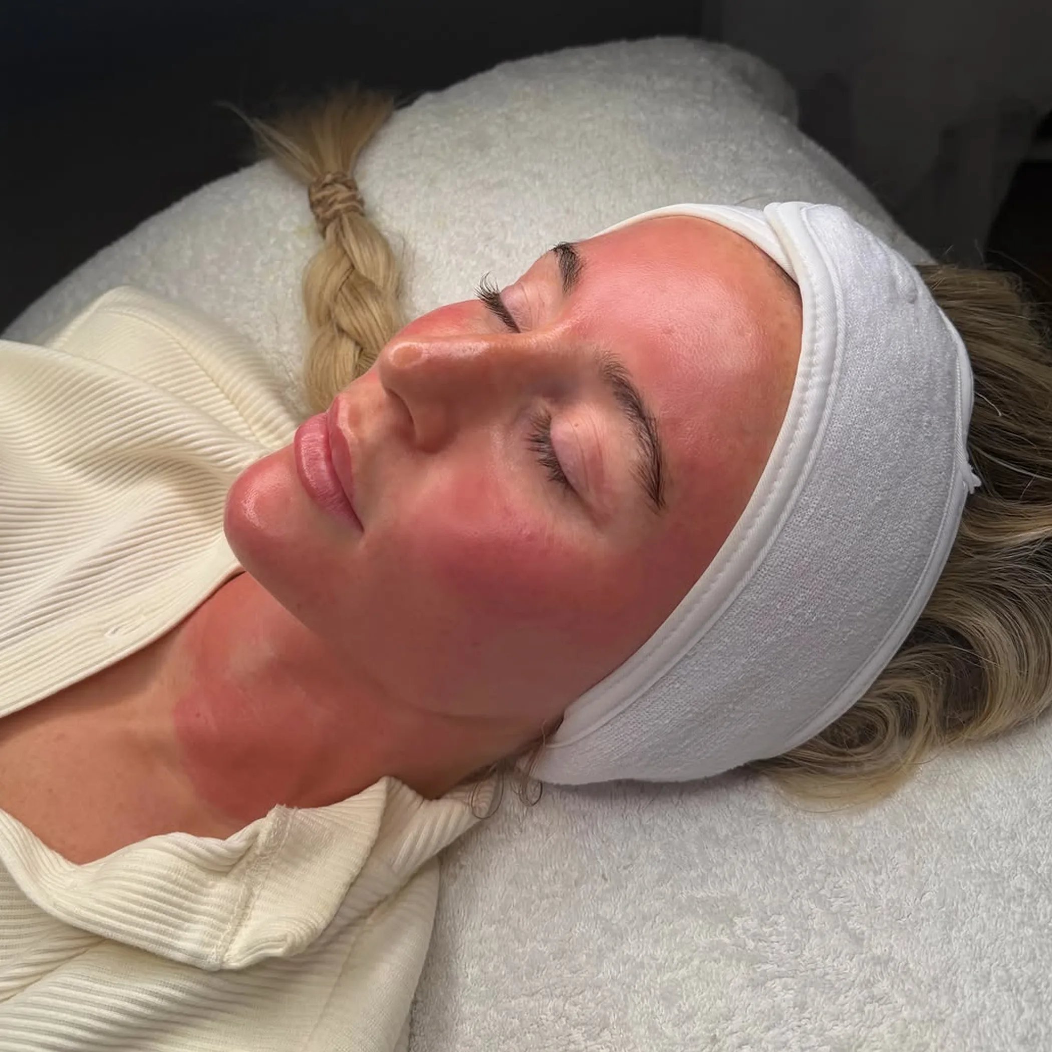 skin rejuvenation treatment