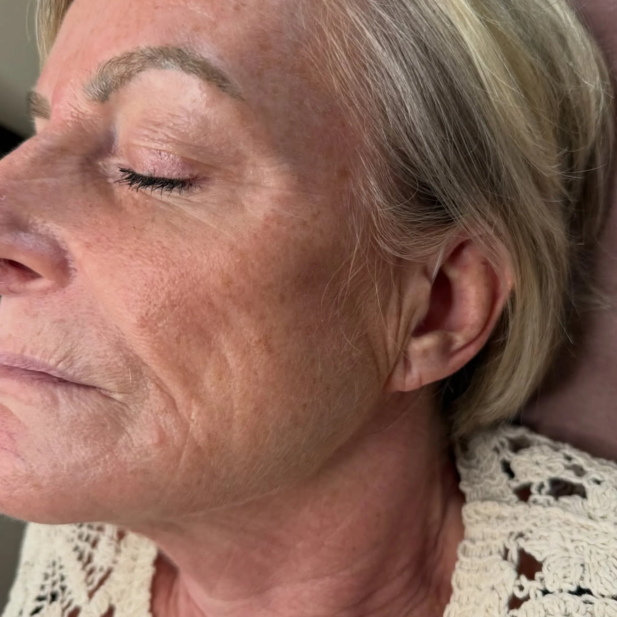 well-lit facial skin close-up